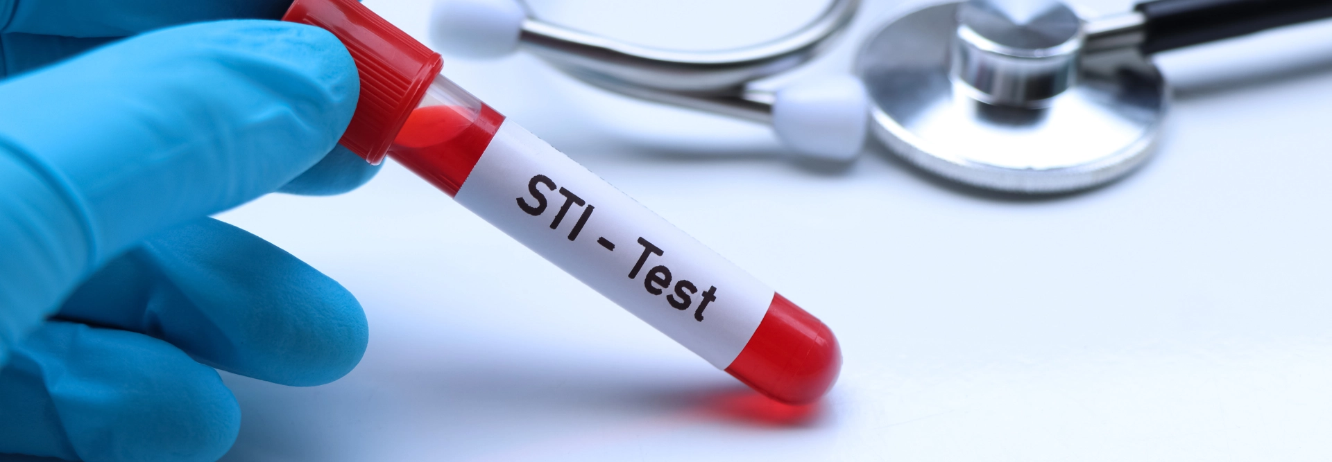 STI testing in Birmingham, Alabama and surrounding areas.